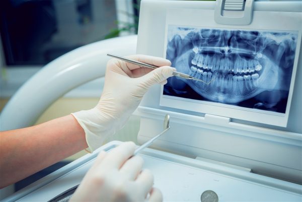 حداقل رتبه لازم برای قبولی در رشته دندان‌پزشکی